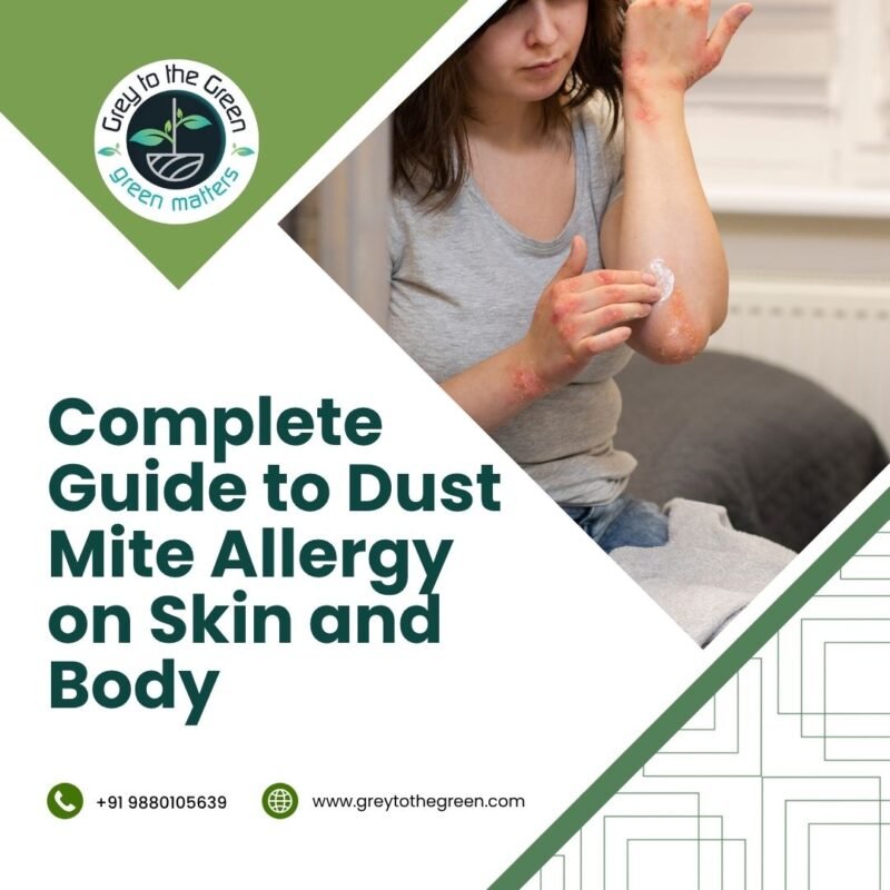 Complete Guide to Dust Mite Allergy on Skin and Body