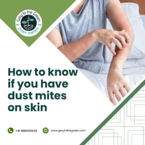 how to know if you have dust mites on skin