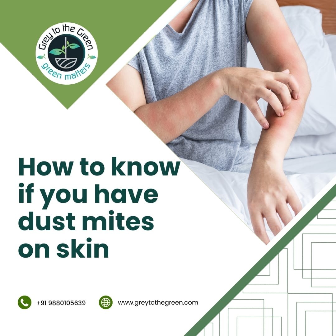 how to know if you have dust mites on skin